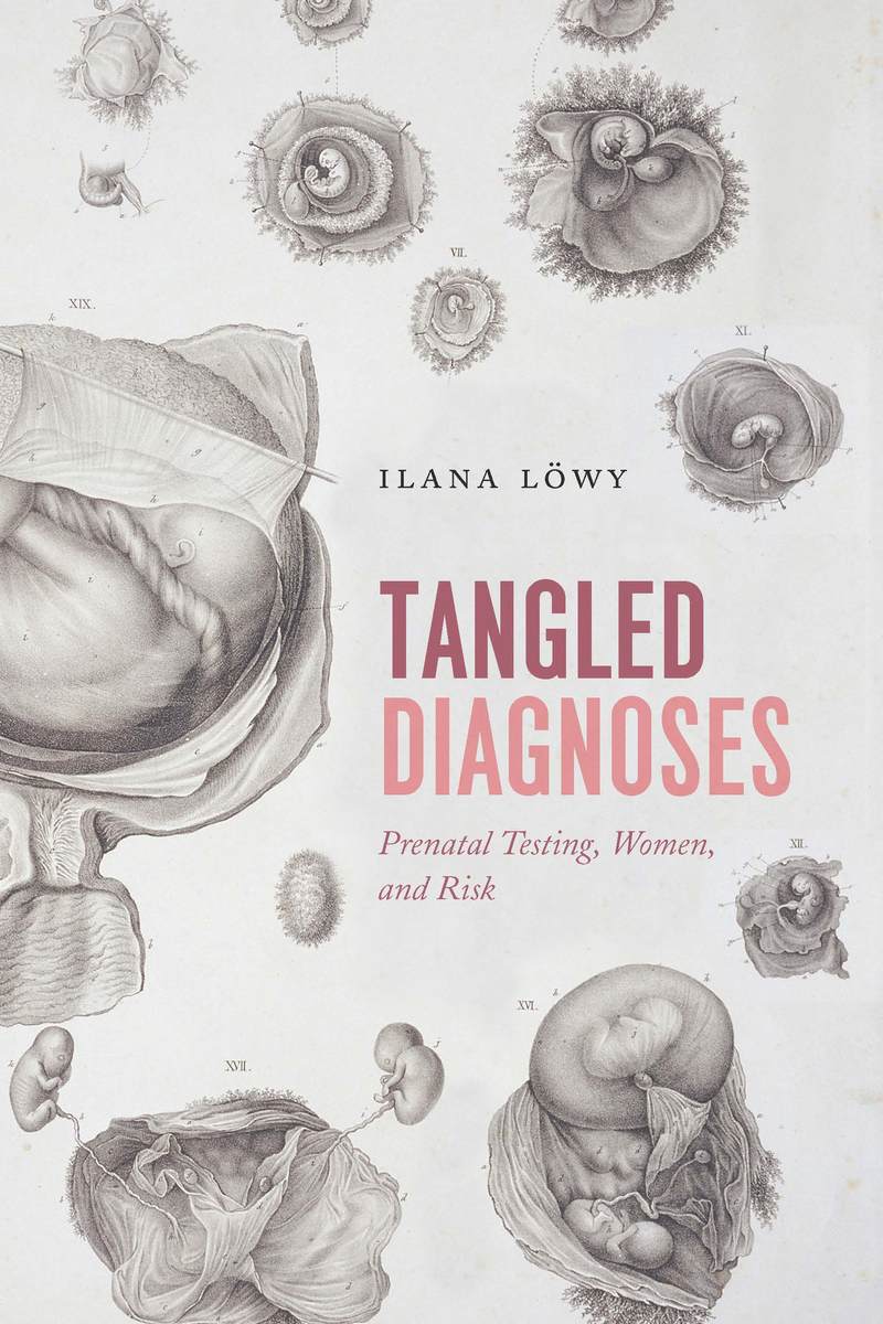 Tangled Diagnoses Prenatal Testing, Women, and Risk, Löwy